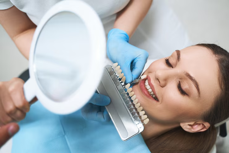 Enhancing Your Smile with Professional Teeth Whitening in Wentzville
