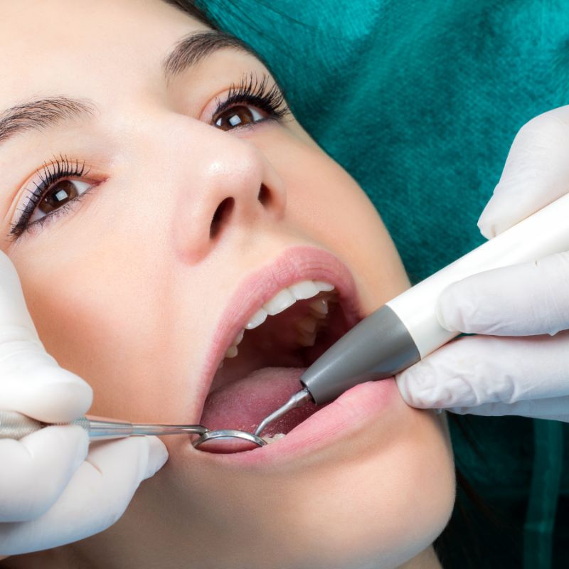 What Is Restorative Dentistry? A Complete Overview of Treatments & Benefits