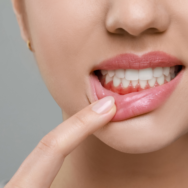 Kraner Family Dentistry|Home