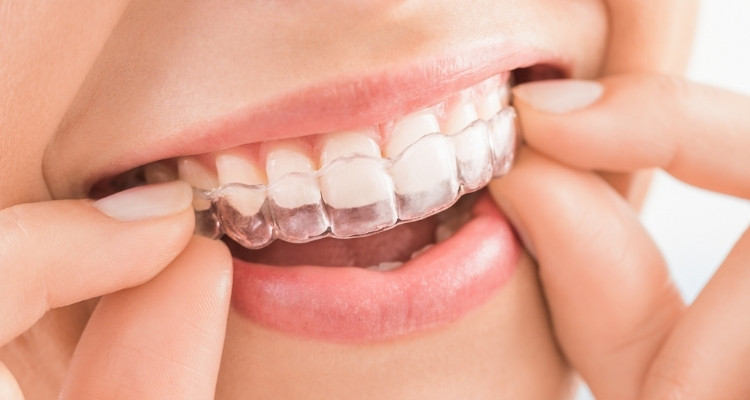 Kraner Family Dentistry | Home