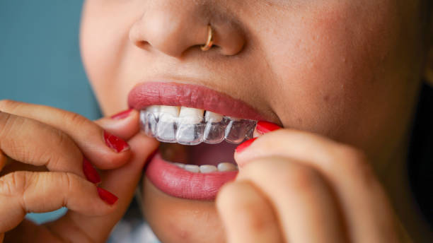 Kraner Family Dentistry | Can Invisalign Close Gaps Between Teeth? Everything You Need to Know Kraner Family Dentistry | Can Invisalign Close Gaps Between Teeth? Everything You Need to Know